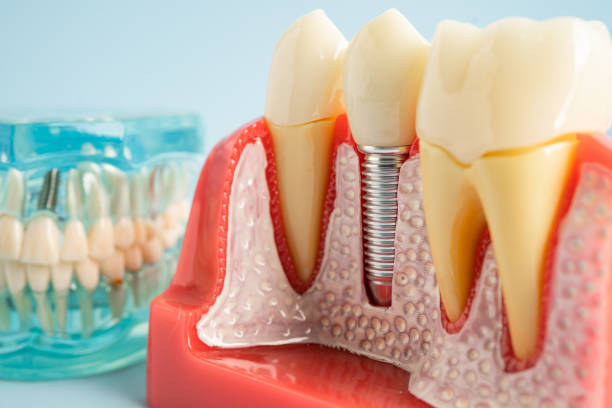 Our Range of Dental Services in Lodi, NJ